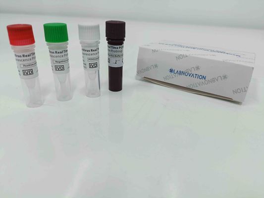 품질  Real Time Monkeypox PCR Test Kit With Positive / Negative Control 공장